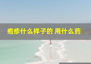 疱疹什么样子的 用什么药